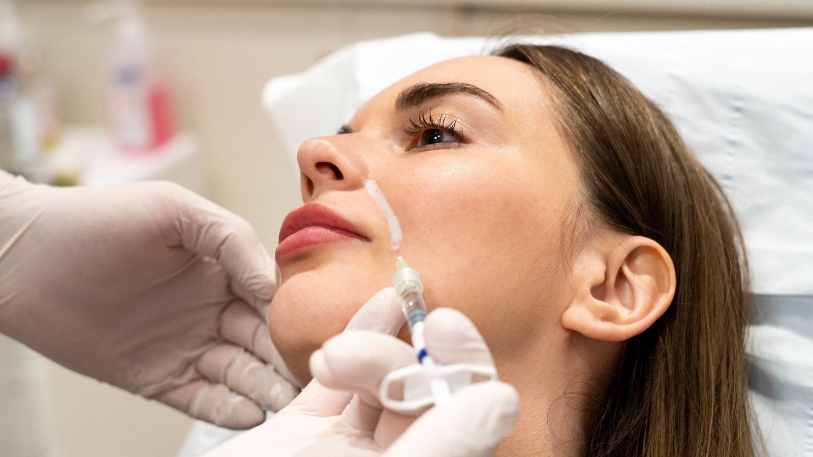 Hyaluronic Acid