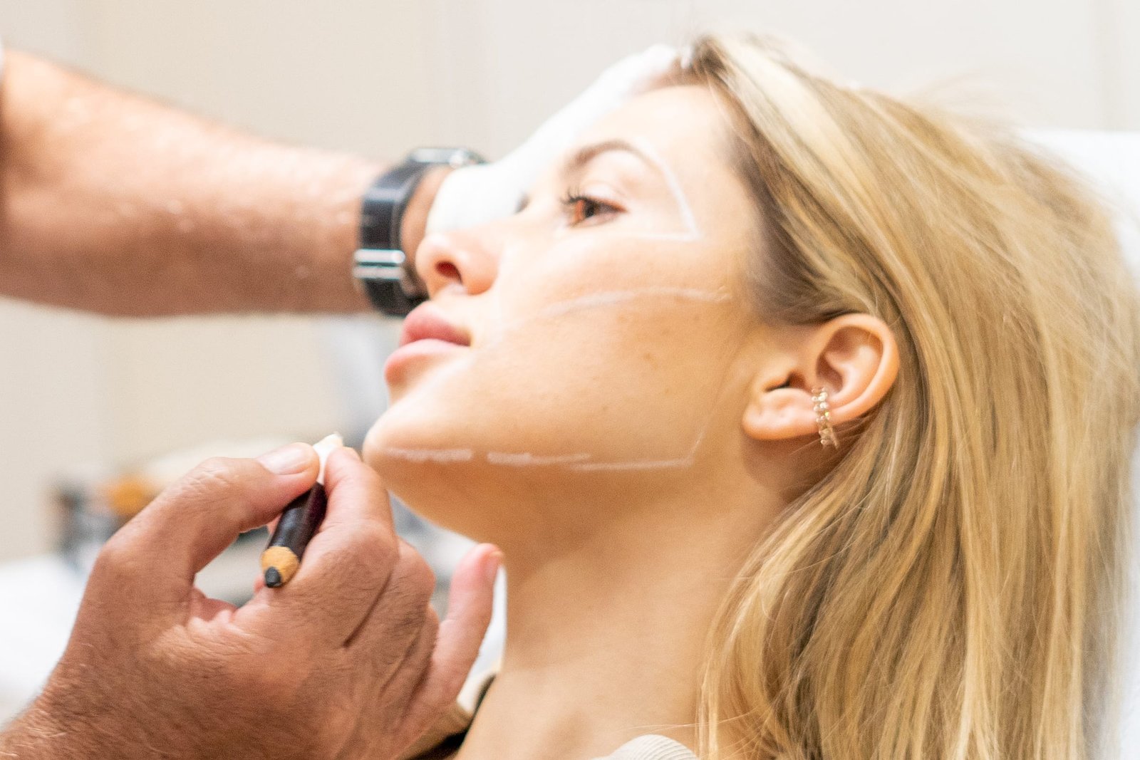 Threadlift