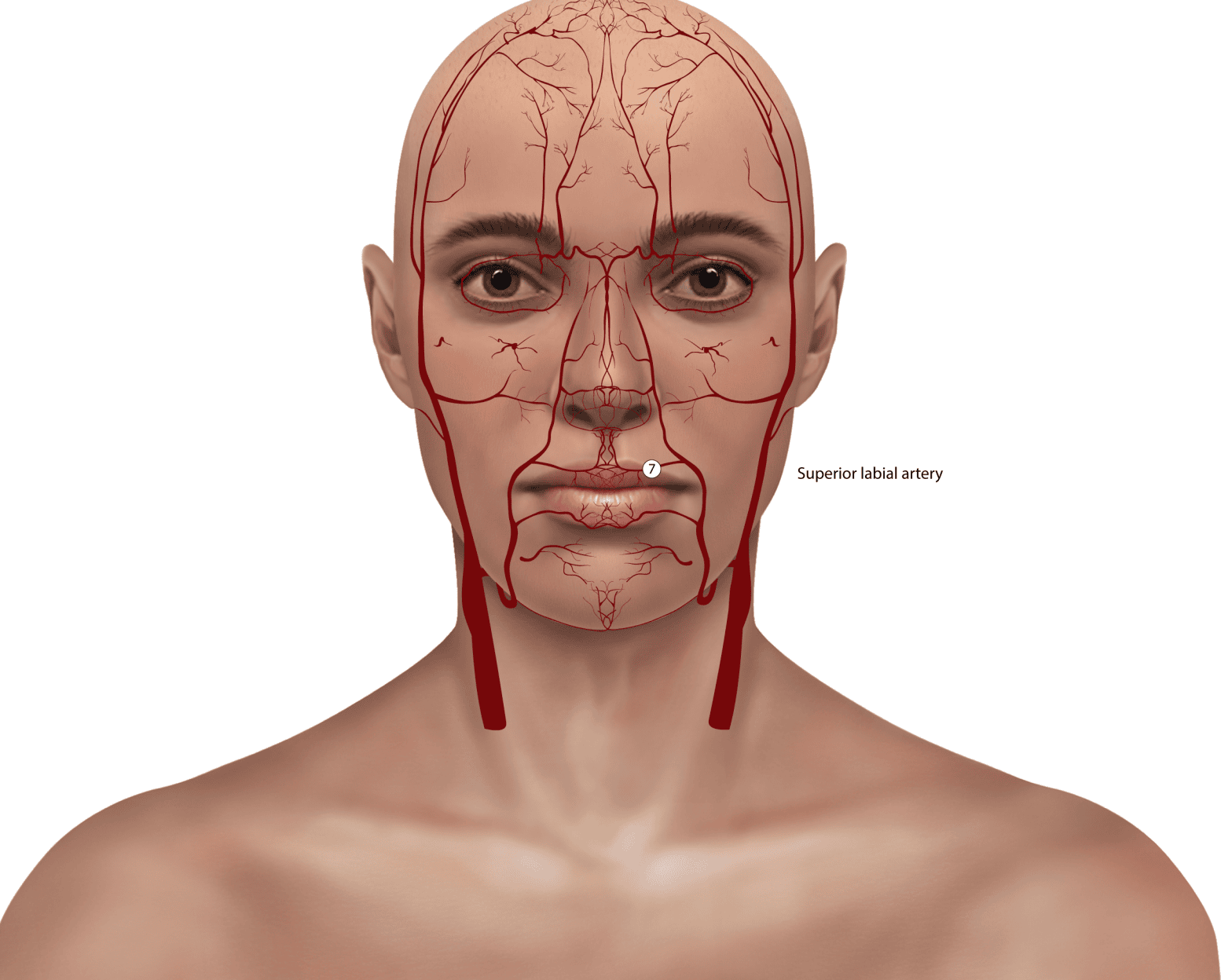 Superior labial artery awareness for safe lip injections