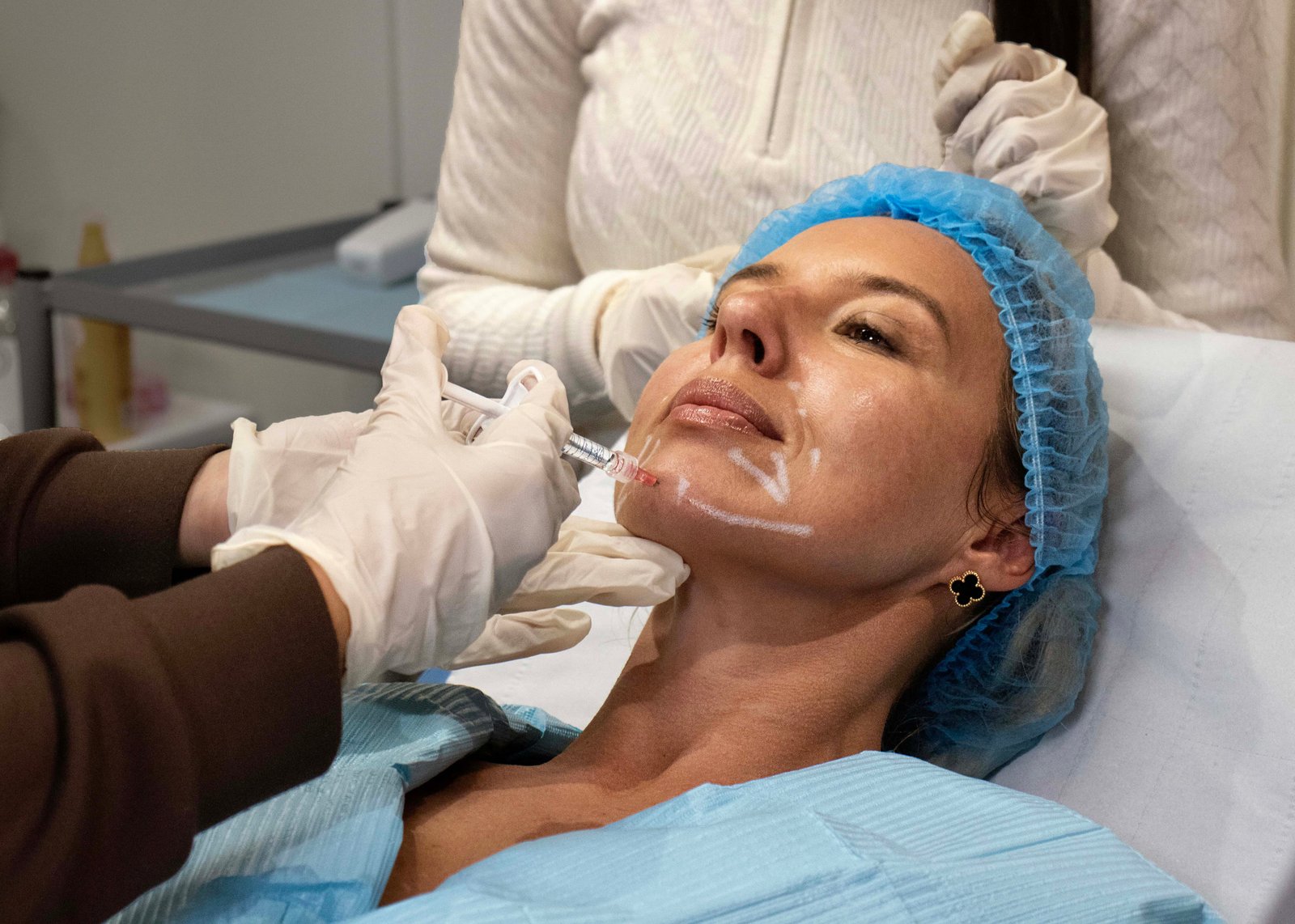 dermal filler training london clinic
