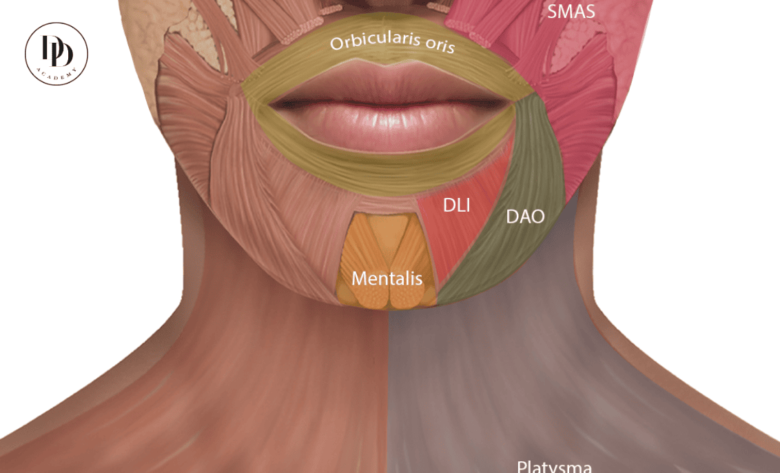 DAO muscle anatomy lower face injection mapping showing depressor anguli oris and surrounding facial muscles