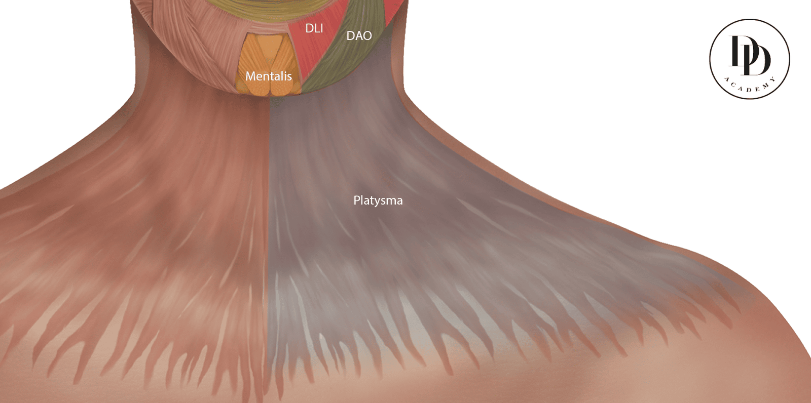 Platysmal bands anatomy neck muscle illustration aesthetic medicine