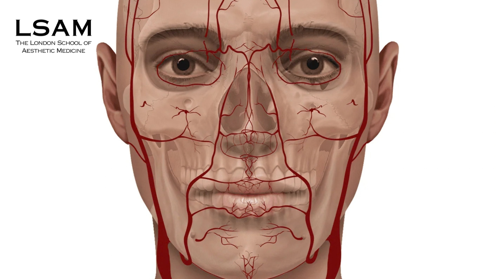 deep piriform space filler injection anatomy nasolabial fold support