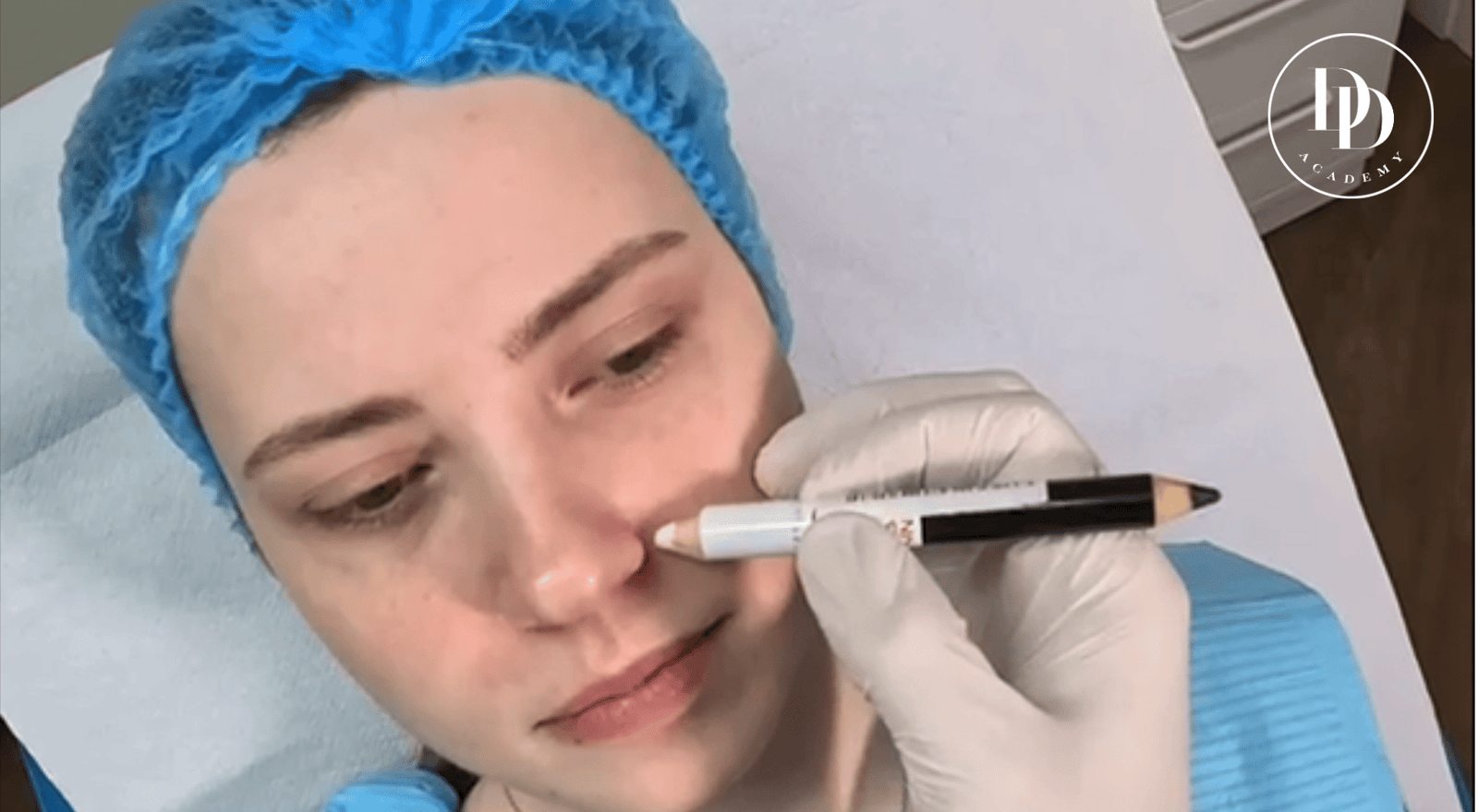 gummy smile botox facial anatomy and upper lip elevator muscles